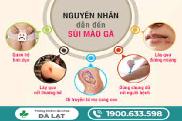 Hình ảnh minh họa